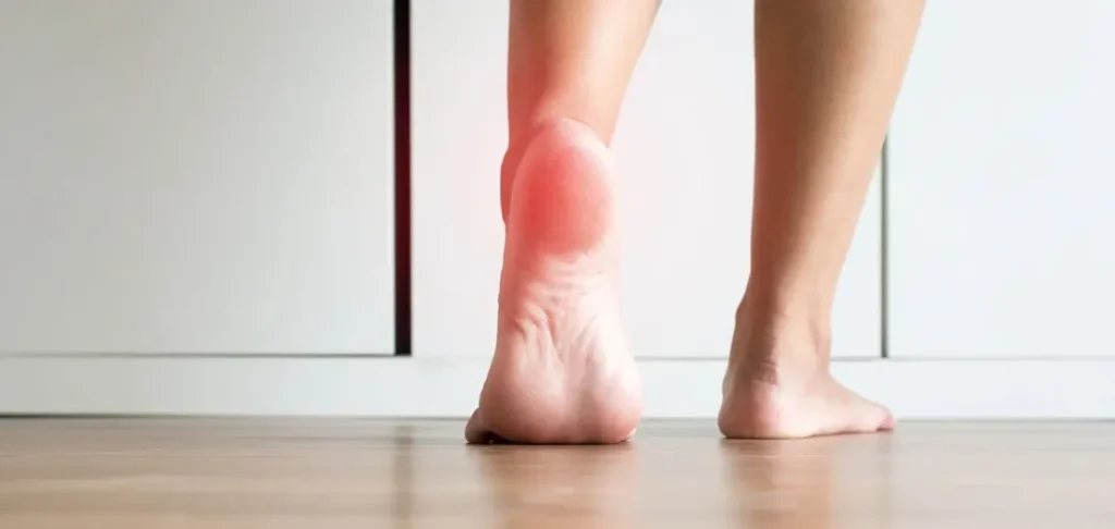 plantarais fascits